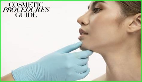 Profile balancing using filler, explained by an expert